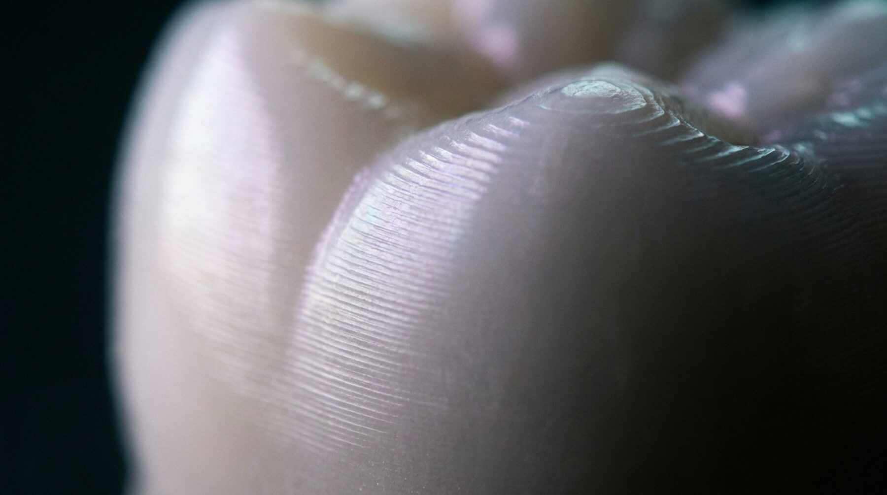 Nahaufnahme der Kaufläche einer gefrästen Krone, die feinen Fräsrillen laufen über die Höcker